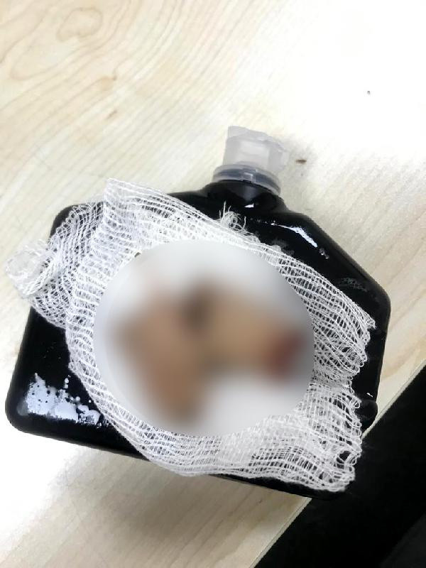 Şampiyonluk kutlamasında havai fişek elinde patlayınca parmakları parçalandı - Resim: 0