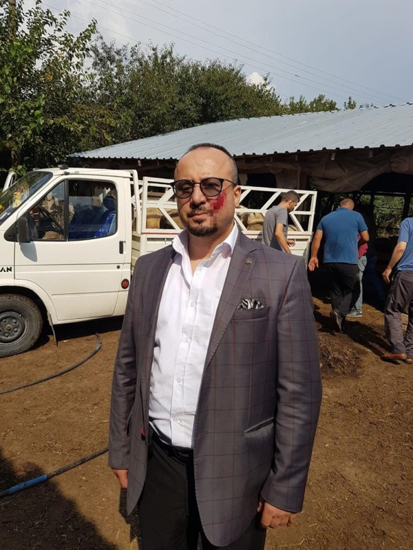 Bursa'da avukat hayatının şokunu yaşadı! Yanağını ısırıp parça kopardı! - Resim: 0