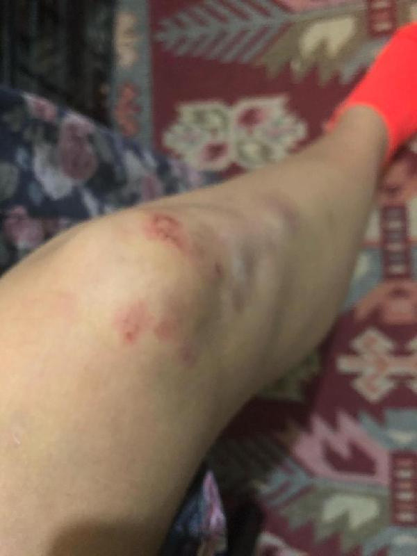 Bağcılar'da sevgilisinin evine bomba attığı kadın: Olaydan önce birçok kez tehdit etti - Resim: 2