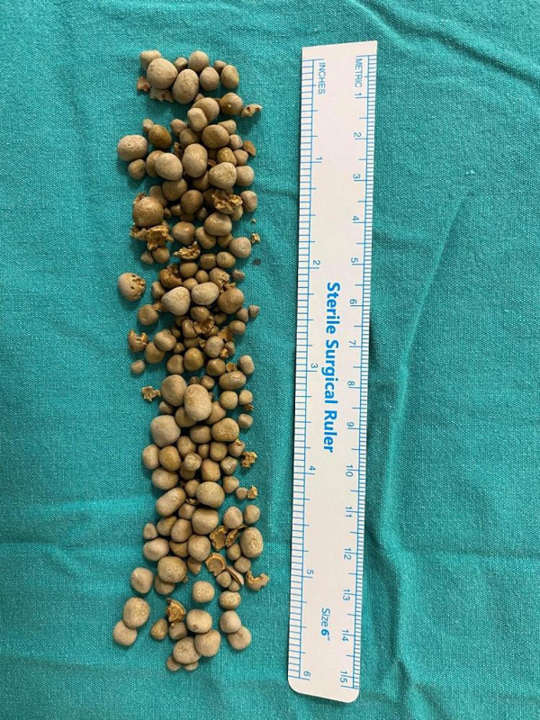 Adana'da ilaçlardan fayda görmedi! Doktorlar görünce şaştı kaldı: Hatıra olarak saklayacak - Resim: 0