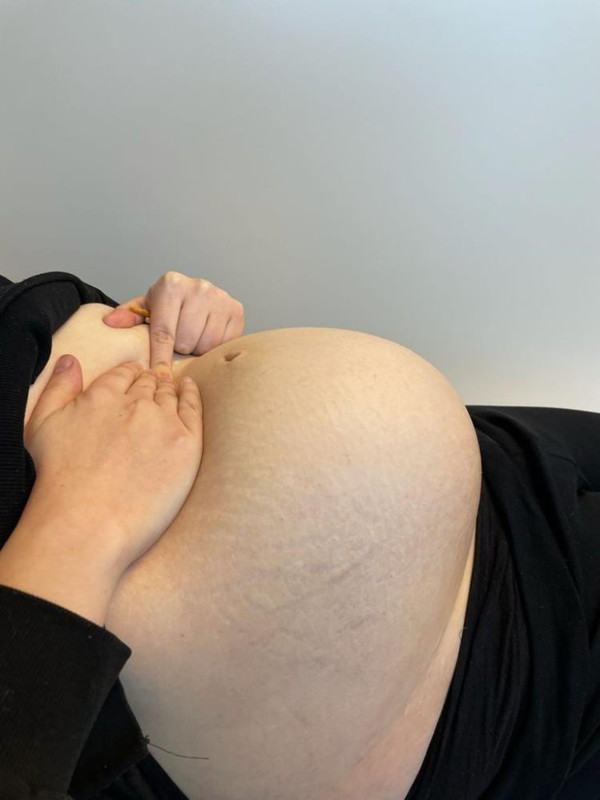 Yıllardır hamile gibi yaşıyordu! Eskişehir'de doktora gidince öğrendiği gerçekle şok oldu - Resim: 1