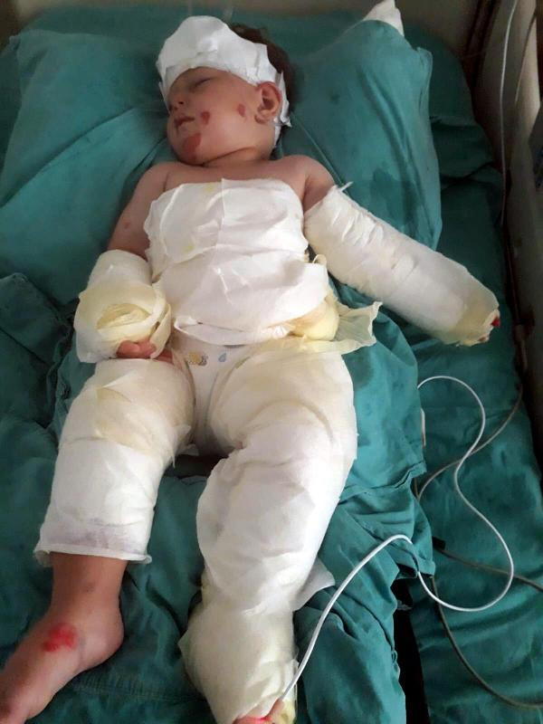 İzmir'de eşi ve oğlunu kolonya döküp yaktı! Öfkeli koca bakın neden yakmış - Resim: 0