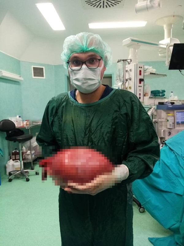 Isparta'da yorgunluk şikayetiyle gitti gerçeği öğrenince pişman oldu! Doktorlar şaştı kaldı: Vücudundan bakın ne çıktı - Resim: 2