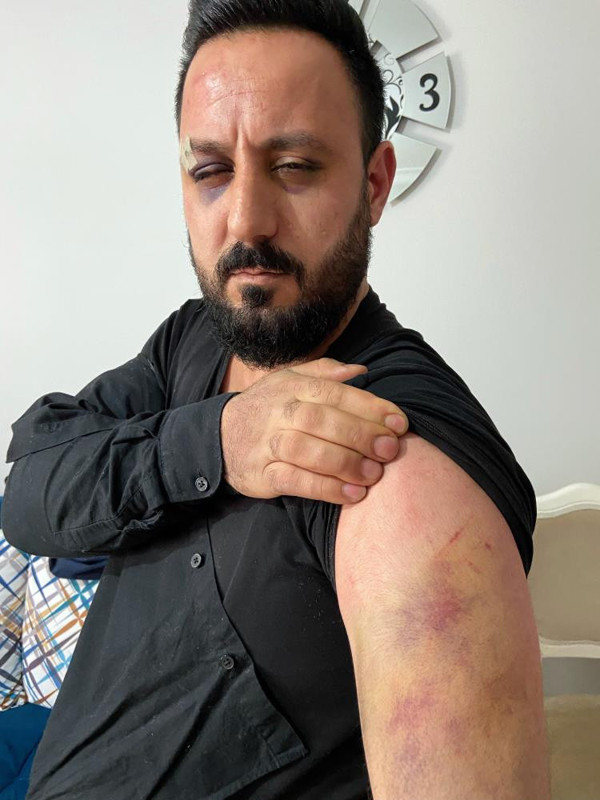 İstanbul'da o soruyu sorunca öldüresiye dayak yedi! Komşuları üstünden geçti: Dakikalarca kendine gelemedi - Resim: 0