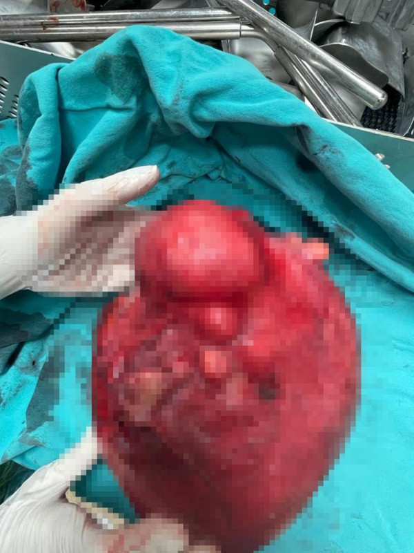 Kars'ta karın ağrısıyla gitti gerçeği öğrenince inanamadı! Karnından bakın ne çıktı - Resim: 0