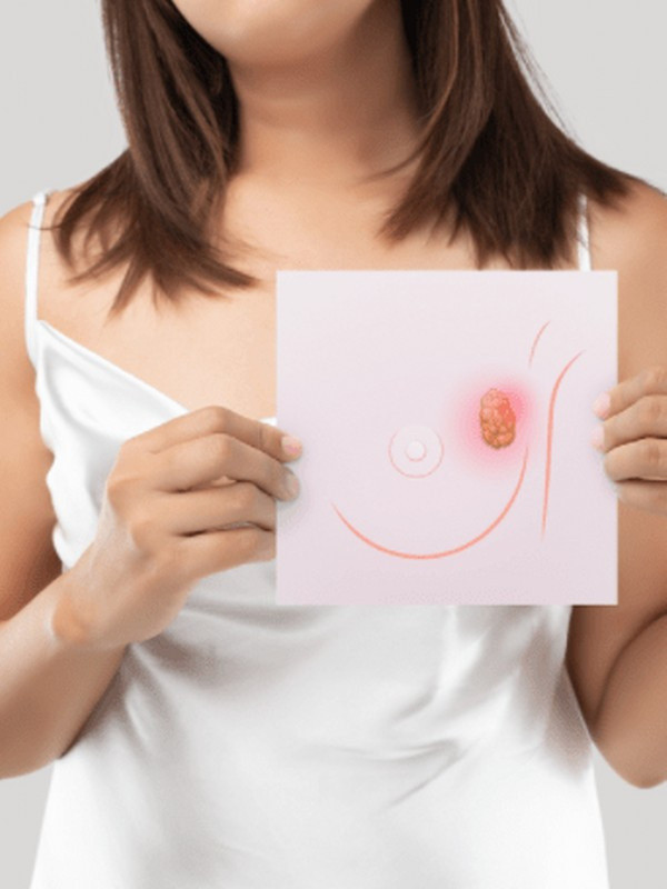 Kadınlar dikkat! Her 9 kişiden 1'i risk altında Evde meme kanseri kontrolü nasıl yapılır? - Resim: 0