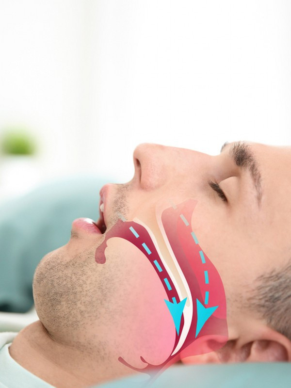 Uyurken horluyorsanız dikkat! Horlamak bu ölümcül hastalığa neden olabilir - Resim: 0