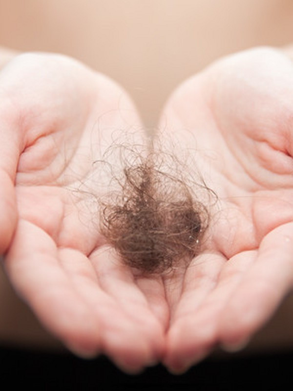 Saç dökülmesi diyip geçmeyin büyük hastalıkların habercisi olabilir - Resim: 1