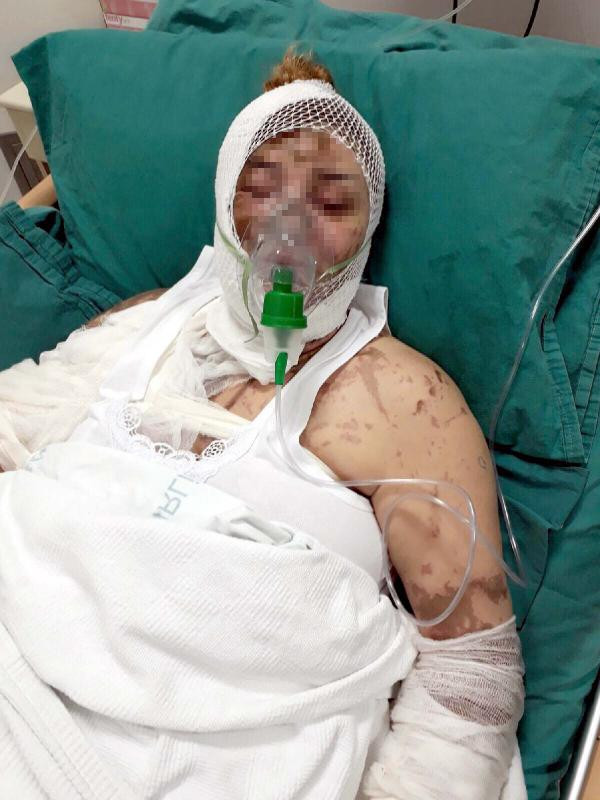 Tecavüze müsade etmeyince dehşeti yaşadı - Resim: 2