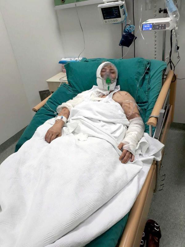 Tecavüze müsade etmeyince dehşeti yaşadı - Resim: 3