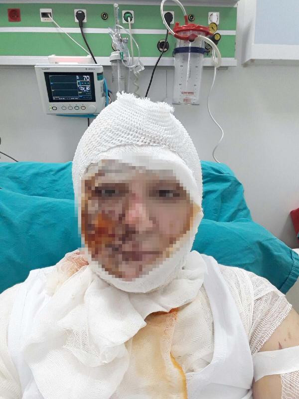 Tecavüze müsade etmeyince dehşeti yaşadı - Resim: 4