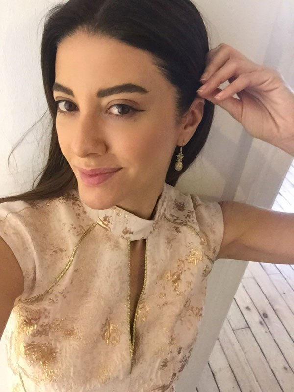 Başak Dizer'in eski haline bakın estetik var mı yok mu? - Resim: 1