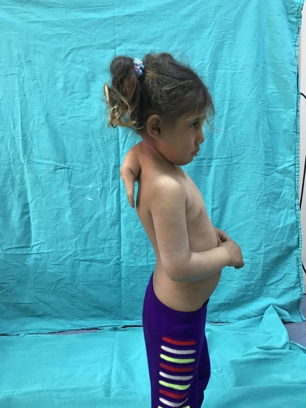 Ensesinden 3. kol çıktı! Doktorlar şoke oldu - Resim: 2