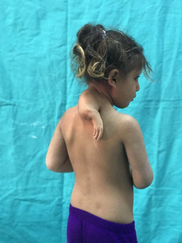 Ensesinden 3. kol çıktı! Doktorlar şoke oldu - Resim: 3