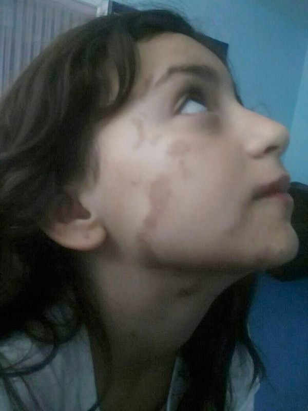 Denizli'de korkunç olay! Uyurken bu hale getirildiler - Resim: 2