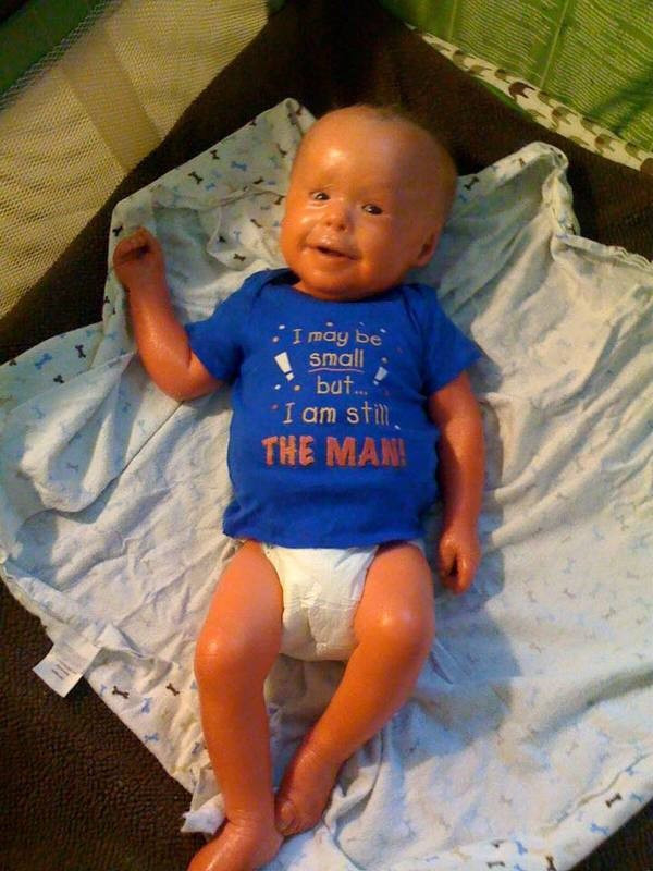 Dünya bu bebeği konuşuyor gelmiş geçmiş en garip hastalık! - Resim: 3