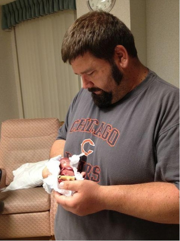 19 haftalık dünyaya geldi bebeği gören herkes şoke oldu - Resim: 4