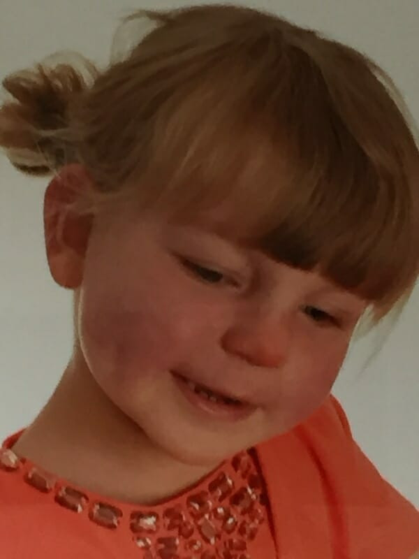 Çocuğun yüzü bu hale geldi acı gerçek ise bambaşka... - Resim: 1