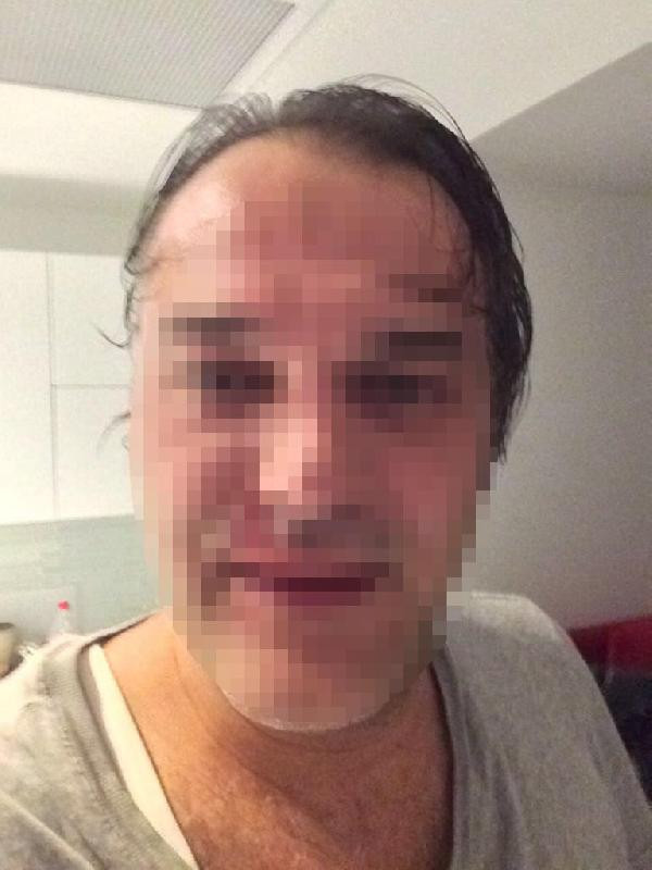 Bu ne biçim öğretim görevlisi! Öğrencisini ne hale soktu - Resim: 1