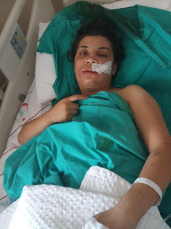 İlişkiye girmeyi reddetti, soda şişesiyle öldüresiye darp edildi! - Resim: 4