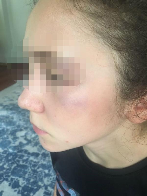 'Antrenör, 14 yaşındaki milli karateciyi yumrukla dövdü' iddiası - Resim: 1