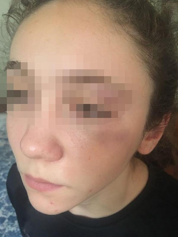 'Antrenör, 14 yaşındaki milli karateciyi yumrukla dövdü' iddiası - Resim: 2