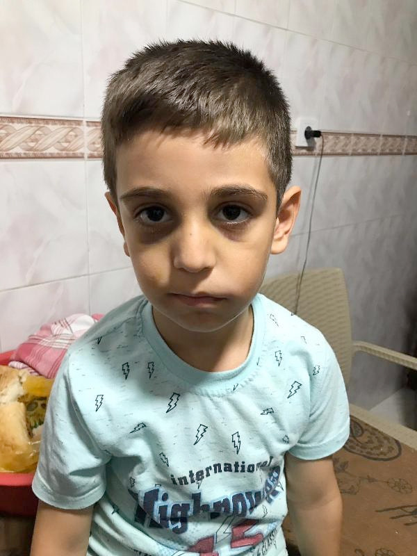 Demir sopa ile öldürelen Mertcan'ın karnesi yürek burktu - Resim: 3