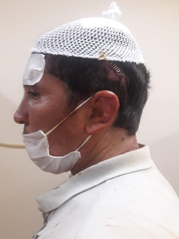 Aydın'da anne ve zihinsel engelli oğluna darp iddiası: Beni yarı çıplak bıraktı.. - Resim: 2