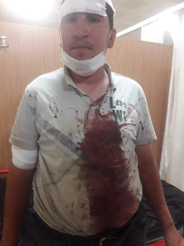 Aydın'da anne ve zihinsel engelli oğluna darp iddiası: Beni yarı çıplak bıraktı.. - Resim: 3