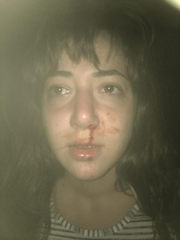 Ayvalık'ta eğlence mekânında anne ve kızına darp iddiası! - Resim: 2