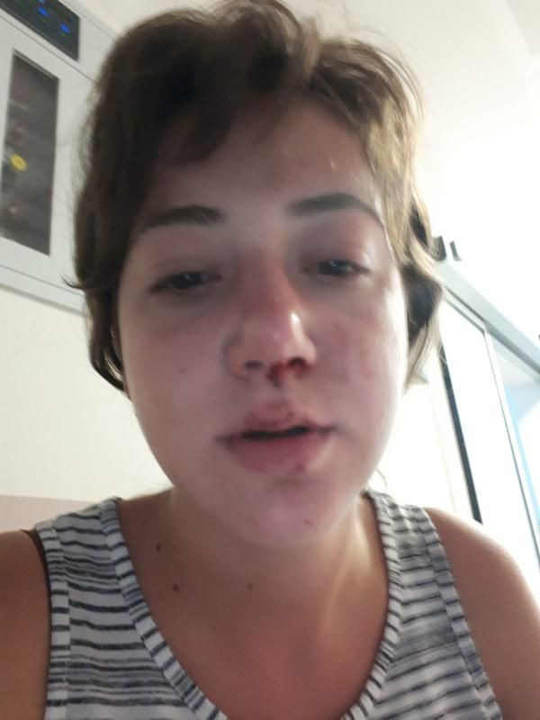 Ayvalık'ta eğlence mekânında anne ve kızına darp iddiası! - Resim: 4