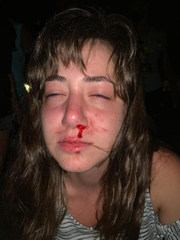 Ayvalık'ta eğlence mekânında anne ve kızına darp iddiası! - Resim: 3