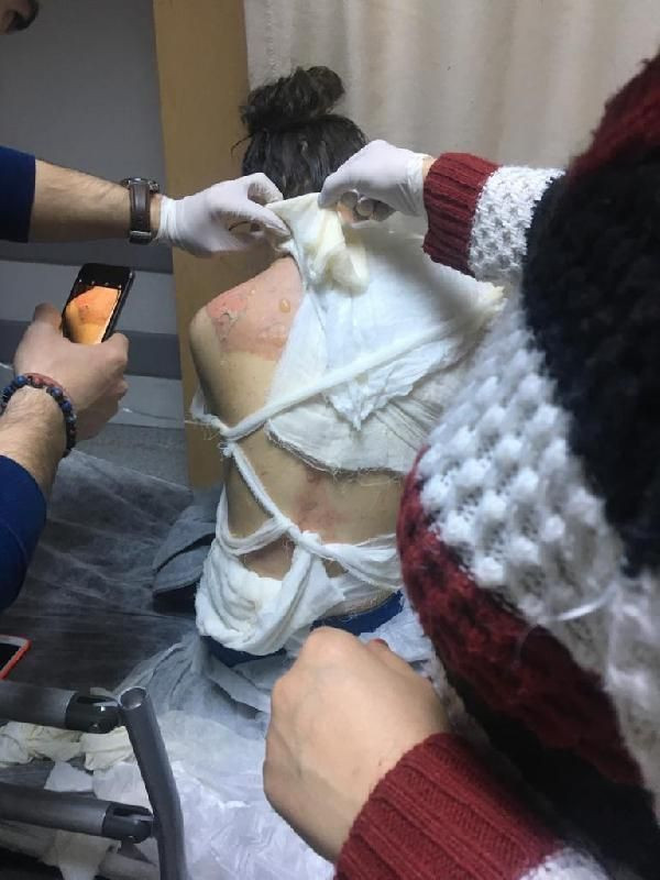 Ümraniye'de üvey anne dehşeti! Kızını kaynar su ile haşlayıp 'yanlışlık oldu' dedi - Resim: 2