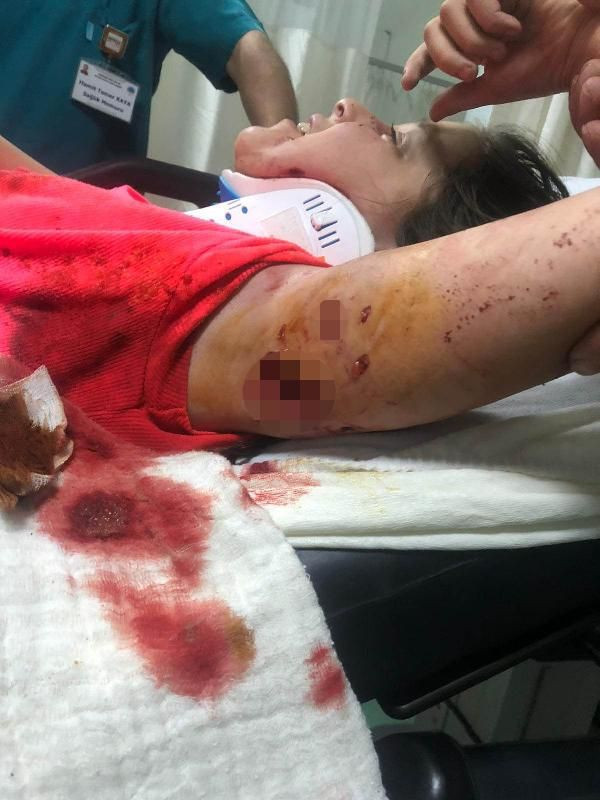 Samsun'da kabus dolu 5 dakika! 12 yaşındaki Tuğba yaşadığı tramvayı atlatamıyor - Resim: 2