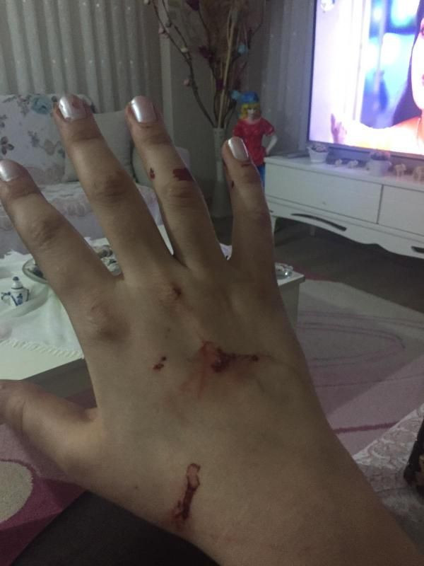 Karabük'te kadına şiddet! Gece saldırdı sabah 'Pide yaptırayım mı?' diye mesaj attı - Resim: 4