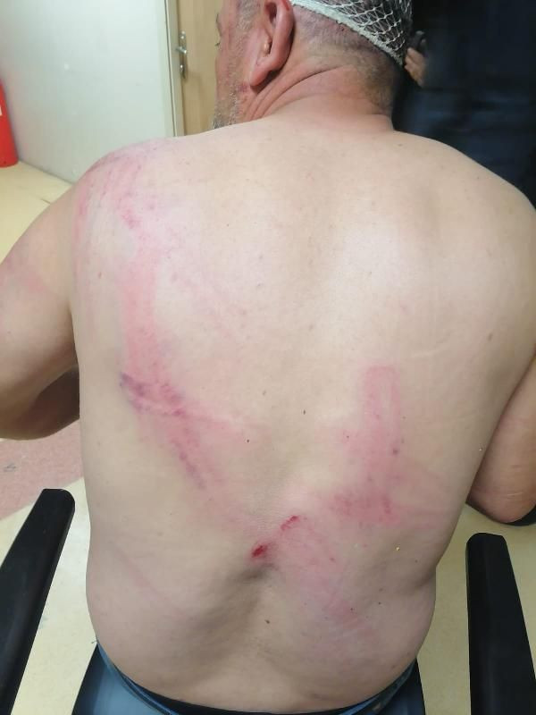 Her satırı dehşet! Çocuklar orakla evimi basıp karnımı deşmek istediler - Resim: 4