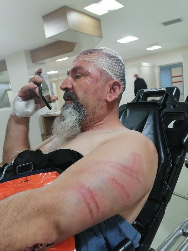 Her satırı dehşet! Çocuklar orakla evimi basıp karnımı deşmek istediler - Resim: 3