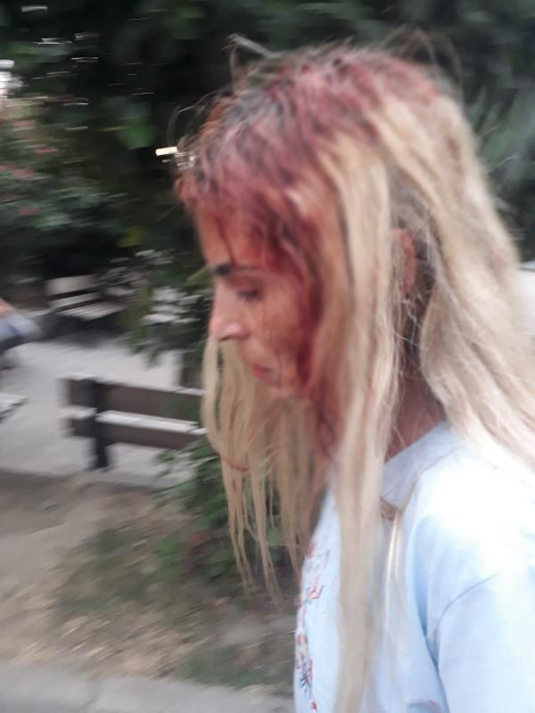 'Öldürülmek istemiyorum' diye haykırmıştı! 19 yıllık eşi evinin önünde kafasını yardı 10 dikiş atıldı - Resim: 3