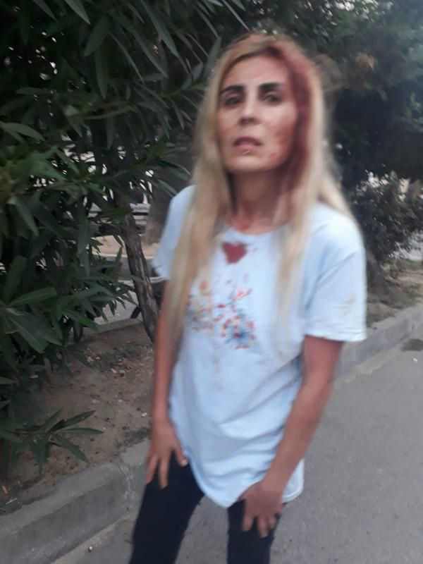 'Öldürülmek istemiyorum' diye haykırmıştı! 19 yıllık eşi evinin önünde kafasını yardı 10 dikiş atıldı - Resim: 4