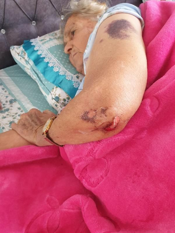 Adana'da yürüyerek girdiği hastaneden yatalak çıktı! Korkunç iddialar - Resim: 1