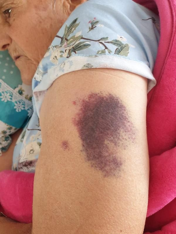 Adana'da yürüyerek girdiği hastaneden yatalak çıktı! Korkunç iddialar - Resim: 2