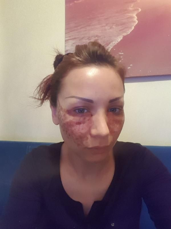 Bulgar modelin estetik kabusu! Kuaför kardeşler: Örümcek ağı yapmadık, iftira - Resim: 3