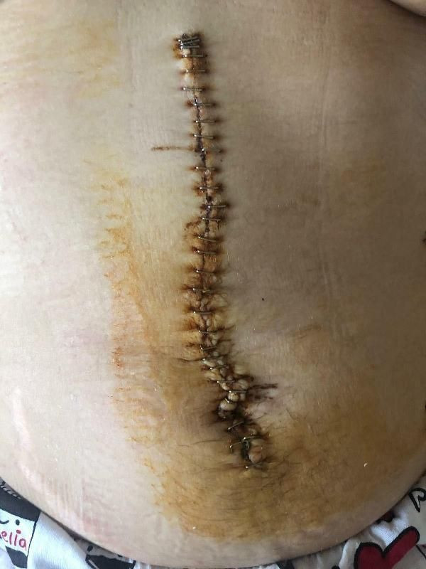 İzmir'de barışma teklifini kabul etmeyen eşini 38 yerinden bıçakladı! 18 yıl hapis cezası onandı - Resim: 4