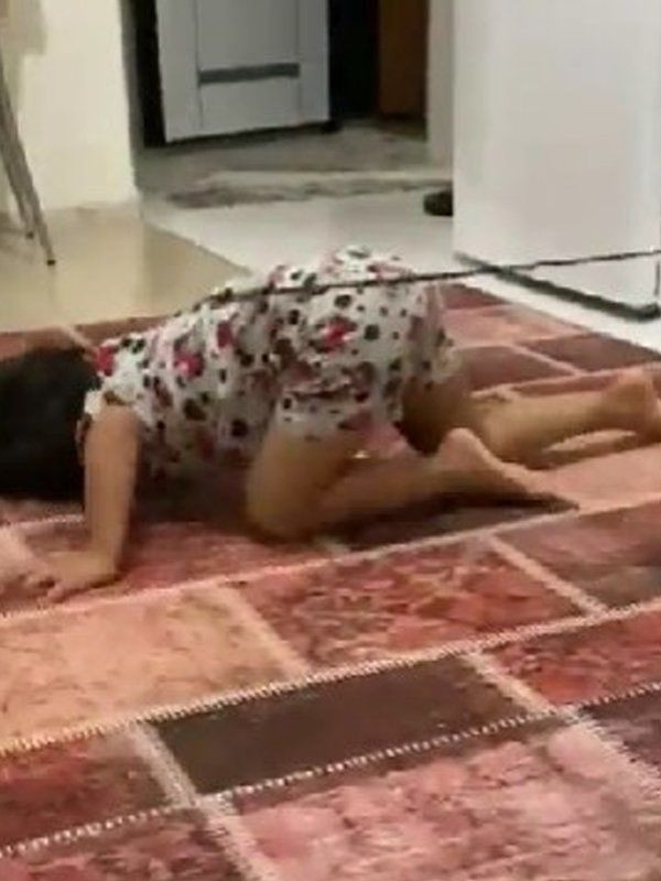 Pitbull saldırısında parçalanan Asiye'ye anne işkencesi! Şok fotoğraflar ortaya çıktı böyle bağlamış! - Resim: 4