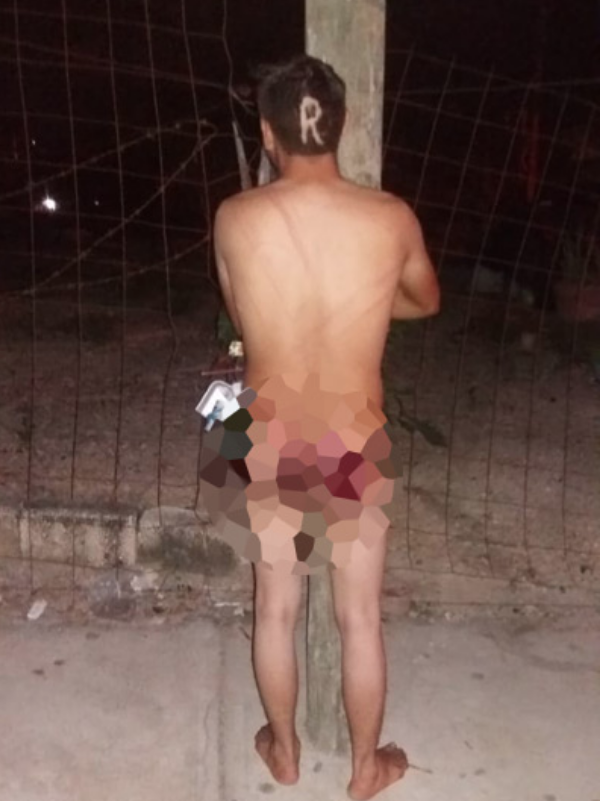 Çıplak halde linç edilip direklere bağlandılar böyle işkence görülmedi - Resim: 2