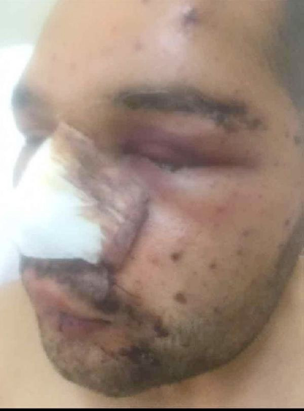 DEAŞ'ın vurduğu tankın içindeki Türk askeri Facebook'a yazdı - Resim: 2