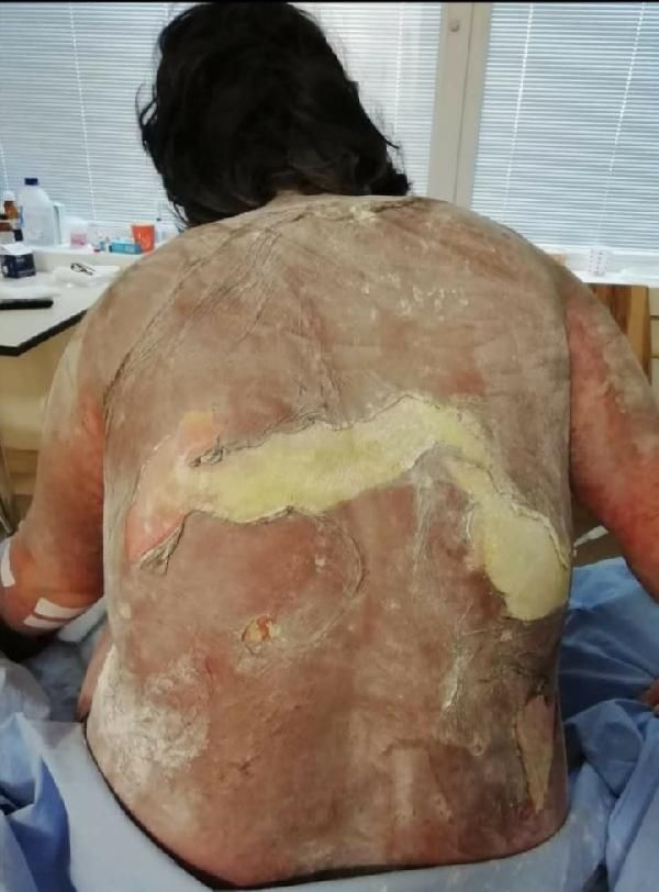 Samsun'da 'hiçbir şey olmaz' dediler bu hale geldi! Hayatı altüst oldu - Resim: 2