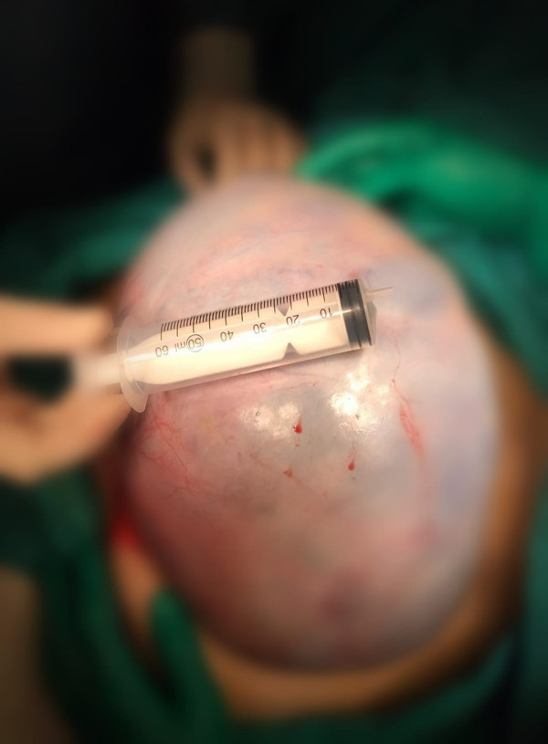 Antalya'da karın ağrısıyla gitti 1,5 saatte çıkarıldı! Doktorlar şaştı kaldı - Resim: 0