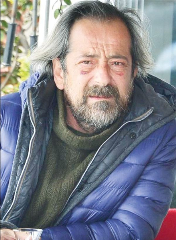 Feridun Düzağaç operasyon geçirdi göz altı morlukları için 'dayak yedim' dedi - Resim: 3