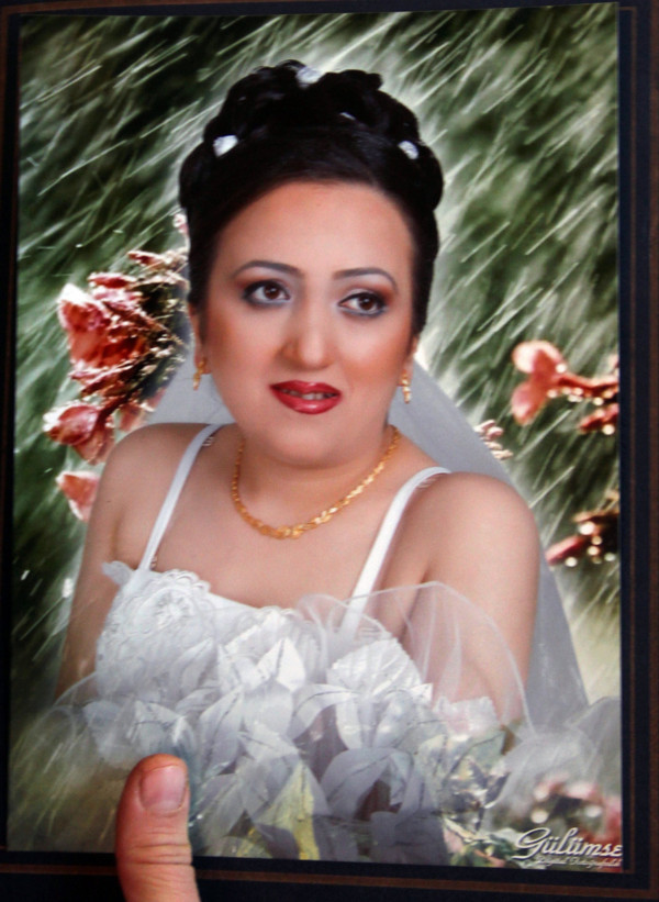 Antalya'da boyun ağrısıyla gitti ameliyat oldu! Giresunlu hemşire hayatının şokunu yaşadı - Resim: 1